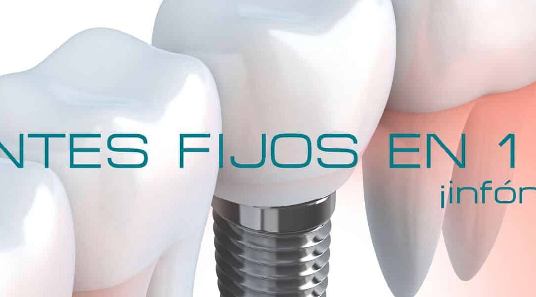 ¿Dientes fijos en un día? Infórmate. Ven a vernos ;)