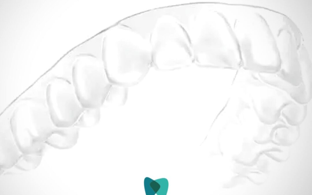 ¿Has pensado alguna vez en las ventajas de la #ortodonciainvisible?