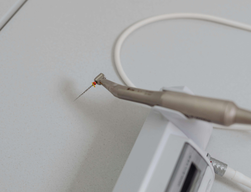 ¿Las endodoncias duelen mucho? Mitos, realidad y cómo se realiza el tratamiento
